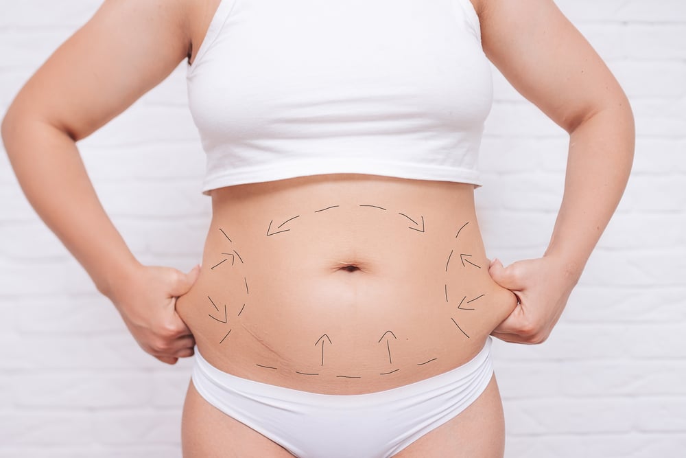 How Body Contouring Can Enhance Your Weight Loss Journey | Aesthetic Essentials